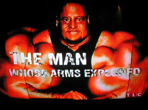 Man whose arms exploded artwork