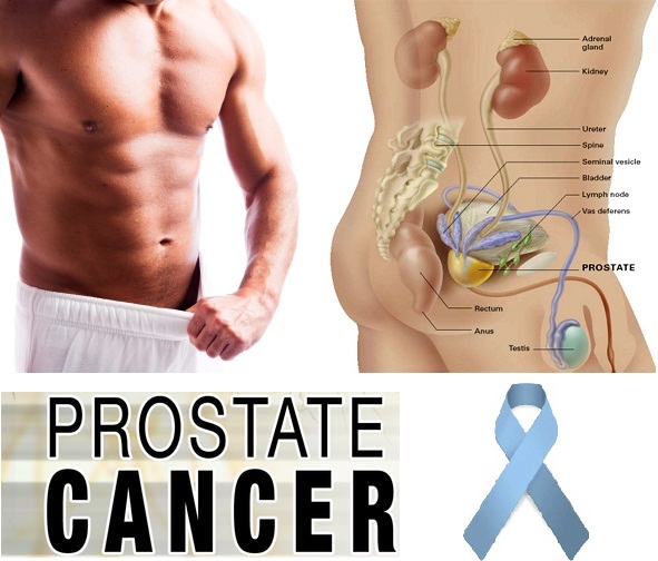 Prostate Cancer DVD artwork
